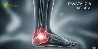 how long can i live with pavatalgia